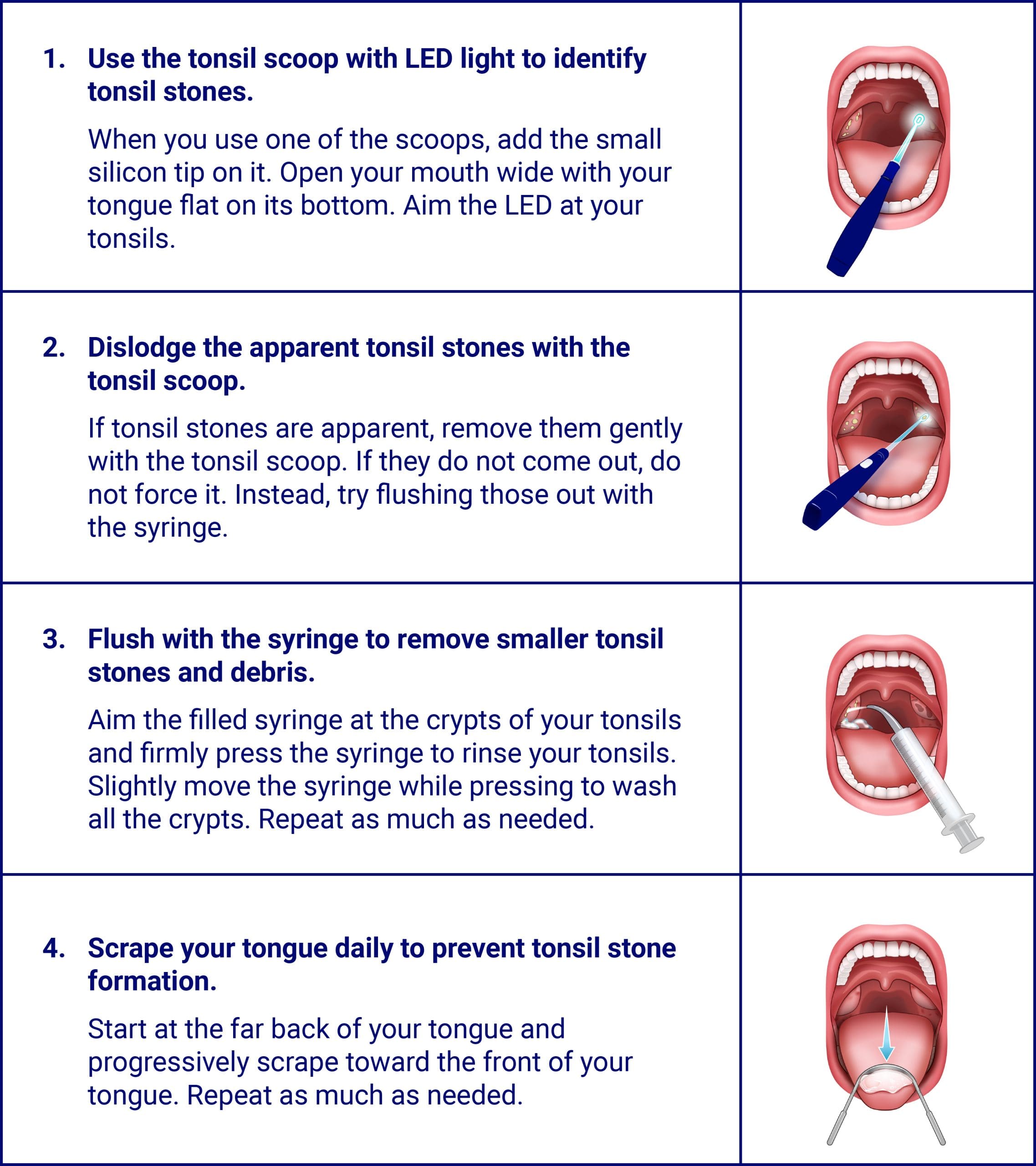 step-by-step-guide-how-to-use-oravix-tonsil-stone-removal-kit