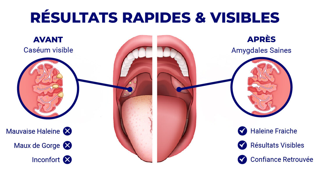 before and after oravix tongue scraper effect