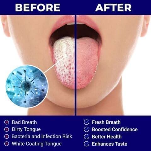 Metal Tongue Scraper | ORAVIX